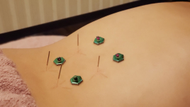 表参道ポルクス整骨院 鍼灸コースのメニュー画像