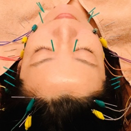 シャルム  美容鍼灸 オプション　立体造顔電流美顔鍼のメニュー画像