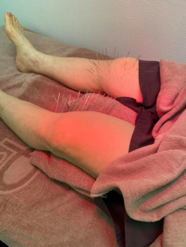 戸澤治療院 特殊鍼法のメニュー画像