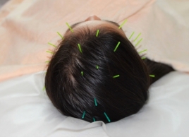 鍼灸Salon心美 徹底的に頭のメニュー画像