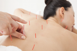 さくら鍼灸整骨院 鍼治療コースのメニュー画像