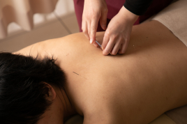 都賀駅前整骨院 鍼治療（全身）のメニュー画像