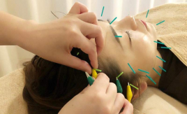 鍼灸U.堂島 電気を流す顔鍼コースのメニュー画像