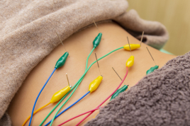 野本鍼灸整骨院　東十条院 トリガー鍼のメニュー画像