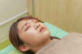 泉尾松浦鍼灸整骨院 眼精疲労のメニュー画像