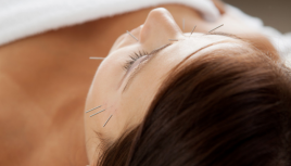 鍼灸サロン 気月水 美容鍼のメニュー画像