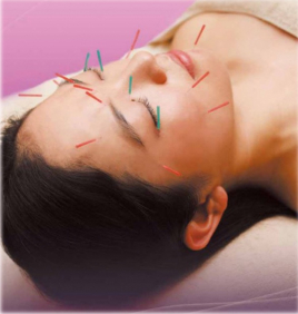 調布エルはりきゅうマッサージ院 美容鍼のメニュー画像