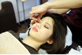 nanairo鍼灸整骨院［薬院］ 【日々のケアに】スタンダード美容鍼コースのメニュー画像