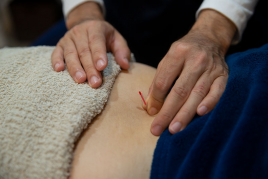 芝浦田町スポーツ整骨院・はり治療院/Tokyo Sports Acupuncture Clinic in Shibaura 鍼　１部位のメニュー画像