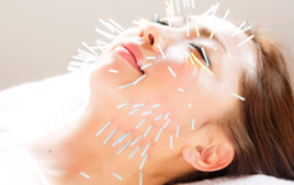 グラン治療院横浜スパイアス院 美容鍼灸60分（お顔+首肩周りの施術）のメニュー画像