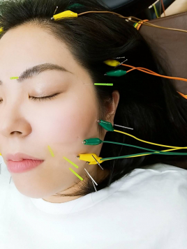 ろはす接骨院・はりきゅう院 立体造顔美容鍼コースのメニュー画像