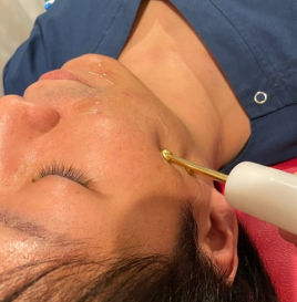 鍼灸院よつば堂 美容鍼コースのメニュー画像