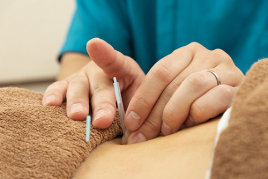 あゆむ鍼灸院整骨院 鍼灸整体のメニュー画像