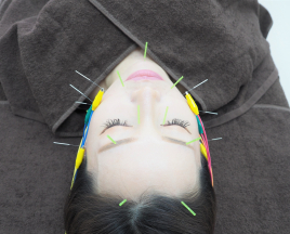 女性の美と健康専門鍼灸院　ハリエッセンス 電気を流すリフトアップ美容鍼コースのメニュー画像