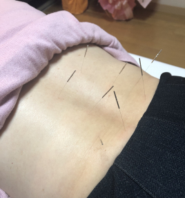 岡山鍼灸院 オーダーメイド治療のメニュー画像