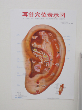 松井山手中西鍼灸院 耳鍼のメニュー画像