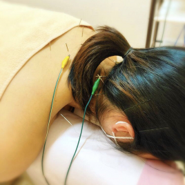 豊橋ふたば接骨院・鍼灸院 鍼治療のメニュー画像