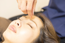 鍼灸·整体院　WATO  2回目以降：美容鍼のメニュー画像