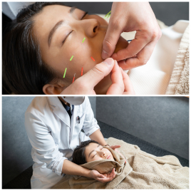 美容鍼灸サロン　REAZZA 小顔特化コース！美容鍼＋小顔矯正のメニュー画像