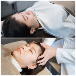 美容鍼灸サロン　REAZZA 疲労改善コース！美容鍼＋ヘッドマッサージのメニュー画像