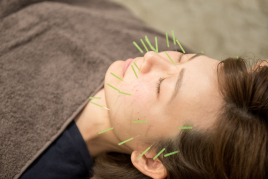 iCure鍼灸接骨院 溜池山王メトロピア 美容鍼灸のメニュー画像