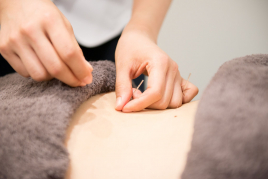 iCure鍼灸接骨院 グランフロント大阪 鍼治療のメニュー画像