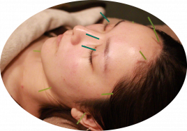 はりきゅうspaceArt 美容鍼灸のメニュー画像