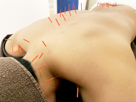 鍼salon N 鍼灸✖︎全身整体(骨盤調整付き)90分のメニュー画像