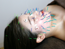 美容鍼灸・温活サロン　supple -サプル- 肌質改善・眼精疲労コースのメニュー画像