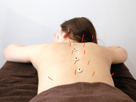 美容鍼灸・温活サロン　supple -サプル- 首肩こり・腰痛解消コースのメニュー画像