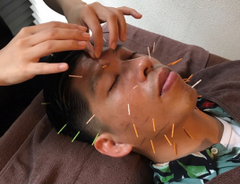 retreat鍼灸院 【ここから下】男性メニューのメニュー画像