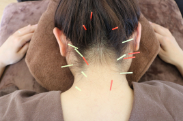 りりあタウン整骨院 鍼灸治療/全身(初回限定50%off)のメニュー画像