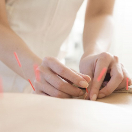 敬和国際医院 鍼灸ルーム あなたの症状・体質に合わせた鍼灸ケアのメニュー画像