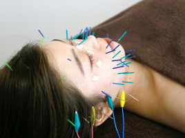美容鍼灸・温活サロン　supple -サプル- リフトアップ・コリすっきりコースのメニュー画像