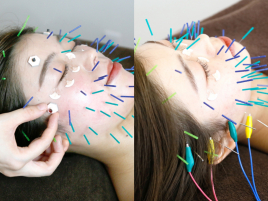 supple〈サプル〉美容鍼灸院 究極の幸せ肌コースのメニュー画像