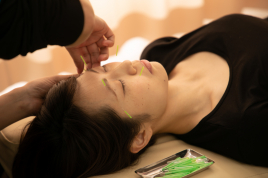 竹の塚トップ鍼灸接骨院 美容鍼（お顔の鍼）レギュラーコースのメニュー画像