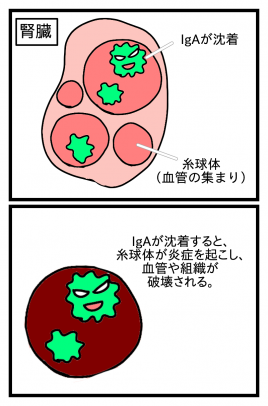 福本鍼灸院 アレルギー性腎炎のメニュー画像