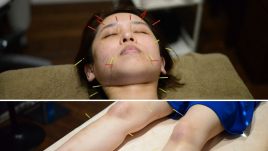 NAKAMIZO美と健康のクリニック ハリウッド式美容鍼灸のメニュー画像