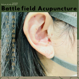 アクア治療院 アメリカ軍使用の戦場鍼 耳鍼治療のメニュー画像