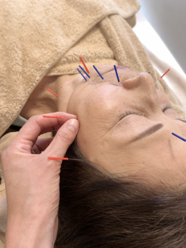 ササノ鍼灸治療院 美容鍼灸コースのメニュー画像
