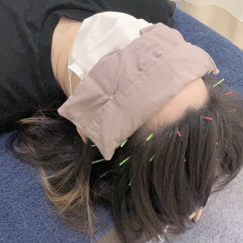 ごほう美サロンレスト re:st 極上のリラックス☆眠り鍼のメニュー画像