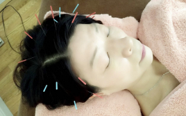 浦和マザー鍼灸院 頭皮鍼・育毛鍼のメニュー画像