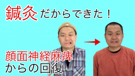 わかば鍼灸院 顔面神経コースのメニュー画像