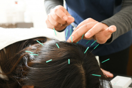パクス・テルレーナ治療室 育毛鍼灸～30分・60分・80分各コースのメニュー画像