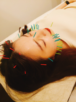 おもいやり鍼灸治療院 美容鍼プレミア(100本)のメニュー画像