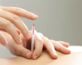 こころ接骨院 鍼治療　おかわりのメニュー画像