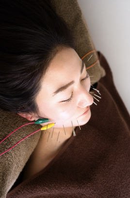 久留米 美容鍼灸院warmly  美容鍼灸［顔］［30本］のメニュー画像