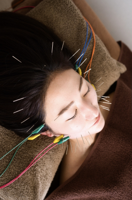 久留米 美容鍼灸院warmly  美容鍼灸［顔･頭］［46本］のメニュー画像