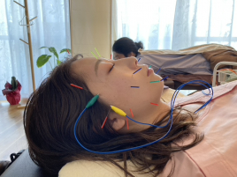 HARIKYULAB 鍼灸、美容鍼、のメニュー画像