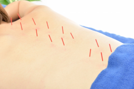 よこまち鍼灸整骨院 悩める神経痛×鍼灸治療のメニュー画像